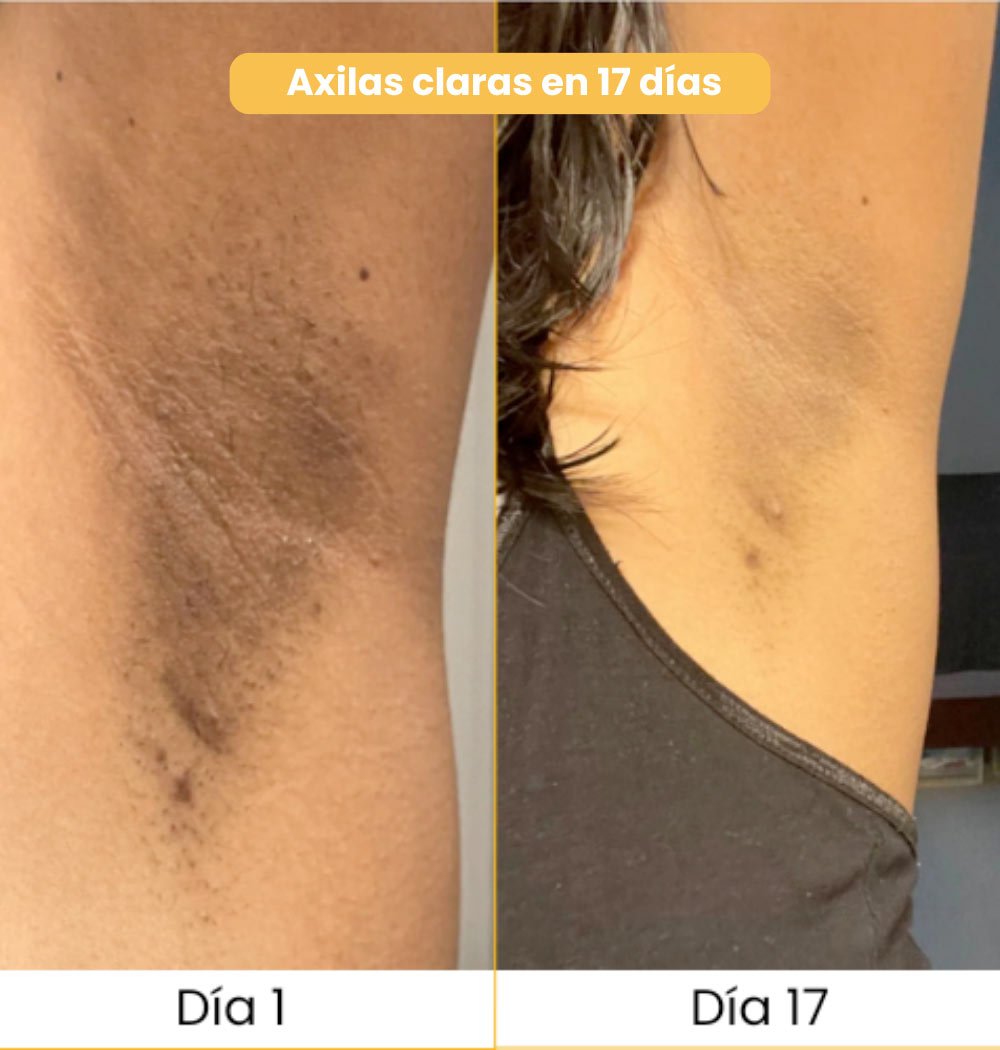 Jabón de Cúrcuma Original — 🔥 OFERTA DE ¡BUEN FIN! Compra 1  y llevate 1 Jabón de Regalo✨ – Elimina manchas y acné rápido 💛 Envío GRATIS 🚚 y Pago al Recibir 💵