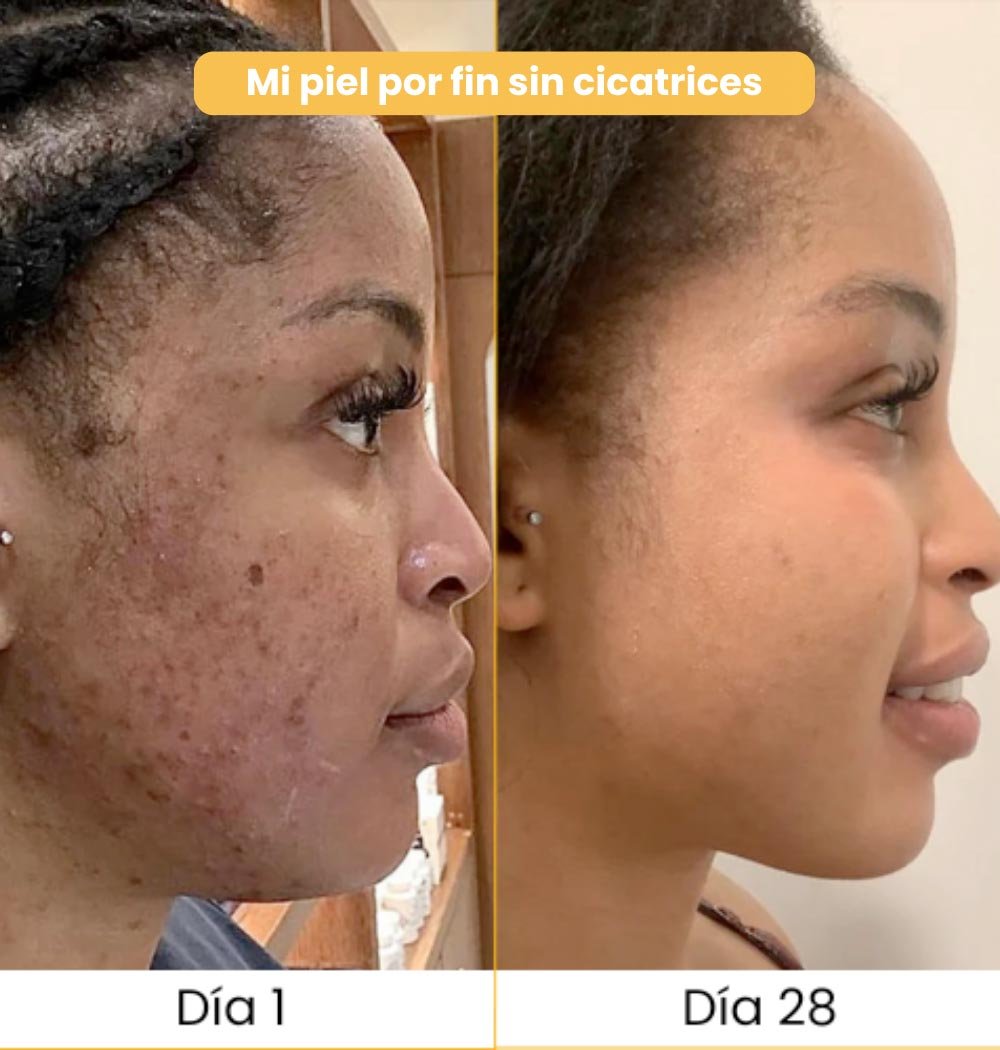 Jabón de Cúrcuma Original — 🔥 OFERTA DE ¡BUEN FIN! Compra 1  y llevate 1 Jabón de Regalo✨ – Elimina manchas y acné rápido 💛 Envío GRATIS 🚚 y Pago al Recibir 💵