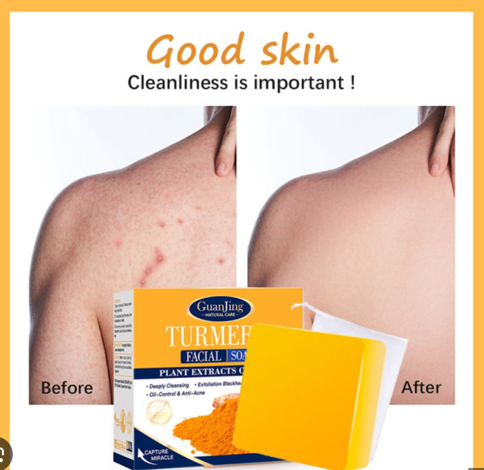 Jabón de Cúrcuma Original — 🔥 OFERTA DE ¡BUEN FIN! Compra 1  y llevate 1 Jabón de Regalo✨ – Elimina manchas y acné rápido 💛 Envío GRATIS 🚚 y Pago al Recibir 💵